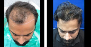 How to Maintain Your Look