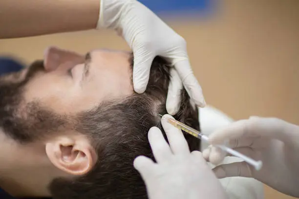 Boosting PRP Effectiveness: Can Combining Therapies Accelerate Hair Regrowth?